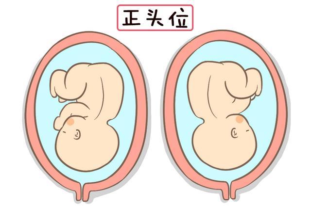 左枕前位胎儿图的相关图片