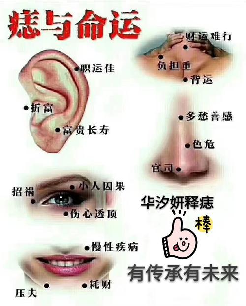 耳廓有痣代表什么的相关图片